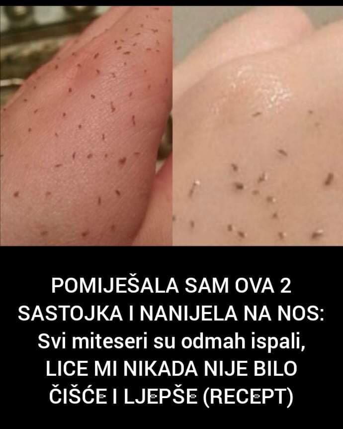 Pogledajte masku od prirodnih sastojaka za uklanjanje mitesera ...